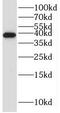 STE20 Related Adaptor Beta antibody, FNab08350, FineTest, Western Blot image 