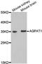 1-Acylglycerol-3-Phosphate O-Acyltransferase 1 antibody, abx004997, Abbexa, Western Blot image 