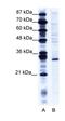 Ring Finger Protein 141 antibody, orb324549, Biorbyt, Western Blot image 