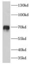 C4BPA antibody, FNab01113, FineTest, Western Blot image 