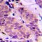 ATP Binding Cassette Subfamily D Member 4 antibody, LS-C352749, Lifespan Biosciences, Immunohistochemistry frozen image 