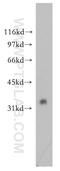 Ring Finger And FYVE Like Domain Containing E3 Ubiquitin Protein Ligase antibody, 12687-1-AP, Proteintech Group, Western Blot image 