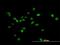 ARK5 antibody, H00009891-B01P, Novus Biologicals, Immunocytochemistry image 