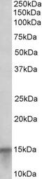 Protein S100-A7 antibody, 46-241, ProSci, Enzyme Linked Immunosorbent Assay image 