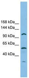 Chromosome transmission fidelity protein 18 homolog antibody, TA344703, Origene, Western Blot image 