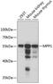 Membrane Palmitoylated Protein 1 antibody, GTX54346, GeneTex, Western Blot image 
