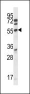 Cyclin Dependent Kinase 15 antibody, 62-962, ProSci, Western Blot image 