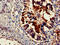 Pre-rRNA-processing protein TSR2 homolog antibody, CSB-PA836166HA01HU, Cusabio, Immunohistochemistry paraffin image 