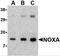 Phorbol-12-myristate-13-acetate-induced protein 1 antibody, 2437, ProSci Inc, Western Blot image 
