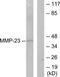 Matrix Metallopeptidase 23B antibody, TA311664, Origene, Western Blot image 