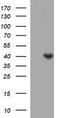 Serpin Family B Member 3 antibody, LS-C788342, Lifespan Biosciences, Western Blot image 