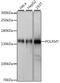 RNA Polymerase Mitochondrial antibody, 16-132, ProSci, Western Blot image 
