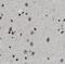 Homeobox protein cut-like 1 antibody, FNab02083, FineTest, Immunohistochemistry paraffin image 