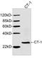 Cardiotrophin-1 antibody, LS-C203226, Lifespan Biosciences, Western Blot image 