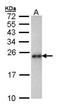 Calcium Regulated Heat Stable Protein 1 antibody, TA308341, Origene, Western Blot image 