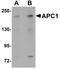 Anaphase Promoting Complex Subunit 1 antibody, A03471, Boster Biological Technology, Western Blot image 