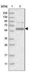 G-Patch Domain Containing 2 antibody, PA5-55536, Invitrogen Antibodies, Western Blot image 