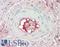 Coagulation Factor II, Thrombin antibody, LS-B10509, Lifespan Biosciences, Immunohistochemistry paraffin image 
