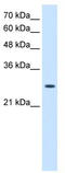 Adenylate kinase 2, mitochondrial antibody, TA338994, Origene, Western Blot image 