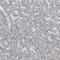 Keratin 20 antibody, HPA027236, Atlas Antibodies, Immunohistochemistry paraffin image 