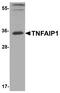 TNF Alpha Induced Protein 1 antibody, PA5-72880, Invitrogen Antibodies, Western Blot image 