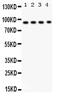 Dipeptidyl Peptidase 4 antibody, PA5-79165, Invitrogen Antibodies, Western Blot image 