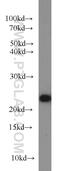 ACOT6 antibody, 22936-1-AP, Proteintech Group, Western Blot image 