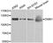 Cytochrome P450 Family 24 Subfamily A Member 1 antibody, orb135367, Biorbyt, Western Blot image 
