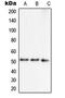 Septin 7 antibody, LS-C351955, Lifespan Biosciences, Western Blot image 