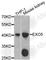 Exonuclease 5 antibody, A8507, ABclonal Technology, Western Blot image 