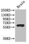 Interactor Of Little Elongation Complex ELL Subunit 1 antibody, LS-C678264, Lifespan Biosciences, Western Blot image 