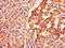 Beta-Transducin Repeat Containing E3 Ubiquitin Protein Ligase antibody, CSB-PA897464LA01HU, Cusabio, Immunohistochemistry frozen image 