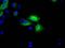 3-Hydroxybutyrate Dehydrogenase 2 antibody, MA5-25141, Invitrogen Antibodies, Immunocytochemistry image 
