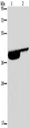 Purinergic Receptor P2X 3 antibody, TA351478, Origene, Western Blot image 