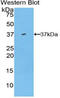 Hepcidin Antimicrobial Peptide antibody, LS-C294486, Lifespan Biosciences, Western Blot image 