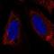 Leucine Zipper Protein 6 antibody, NBP2-58849, Novus Biologicals, Immunocytochemistry image 