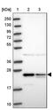Alcohol Dehydrogenase 1A (Class I), Alpha Polypeptide antibody, PA5-61597, Invitrogen Antibodies, Western Blot image 