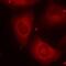 LIM Domain Kinase 2 antibody, NB100-82023, Novus Biologicals, Immunofluorescence image 