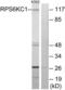 Ribosomal Protein S6 Kinase C1 antibody, LS-B9979, Lifespan Biosciences, Western Blot image 