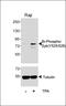 Spleen Associated Tyrosine Kinase antibody, OAAB16125, Aviva Systems Biology, Western Blot image 
