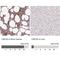CWC25 Spliceosome Associated Protein Homolog antibody, NBP2-49381, Novus Biologicals, Immunohistochemistry paraffin image 