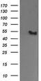 MDM4 Regulator Of P53 antibody, TA505724, Origene, Western Blot image 