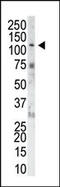 Fibroblast Growth Factor Receptor 1 antibody, 63-079, ProSci, Western Blot image 