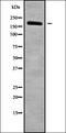 Nucleoporin 155 antibody, orb338504, Biorbyt, Western Blot image 