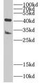Family With Sequence Similarity 185 Member A antibody, FNab02975, FineTest, Western Blot image 