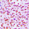 p65 antibody, LS-C352790, Lifespan Biosciences, Immunohistochemistry paraffin image 