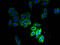 Secretory Carrier Membrane Protein 3 antibody, A54005-100, Epigentek, Immunofluorescence image 