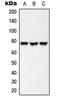 Long-chain-fatty-acid--CoA ligase 6 antibody, LS-C354162, Lifespan Biosciences, Western Blot image 