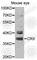 Cone-Rod Homeobox antibody, A5719, ABclonal Technology, Western Blot image 