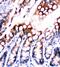 Fatty Acid Binding Protein 5 antibody, PA1853, Boster Biological Technology, Immunohistochemistry frozen image 